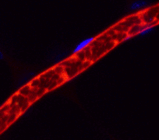 ヒトiPS細胞から作成した血小板（緑色）がマウス血管内（赤色）で止血に働いている様子